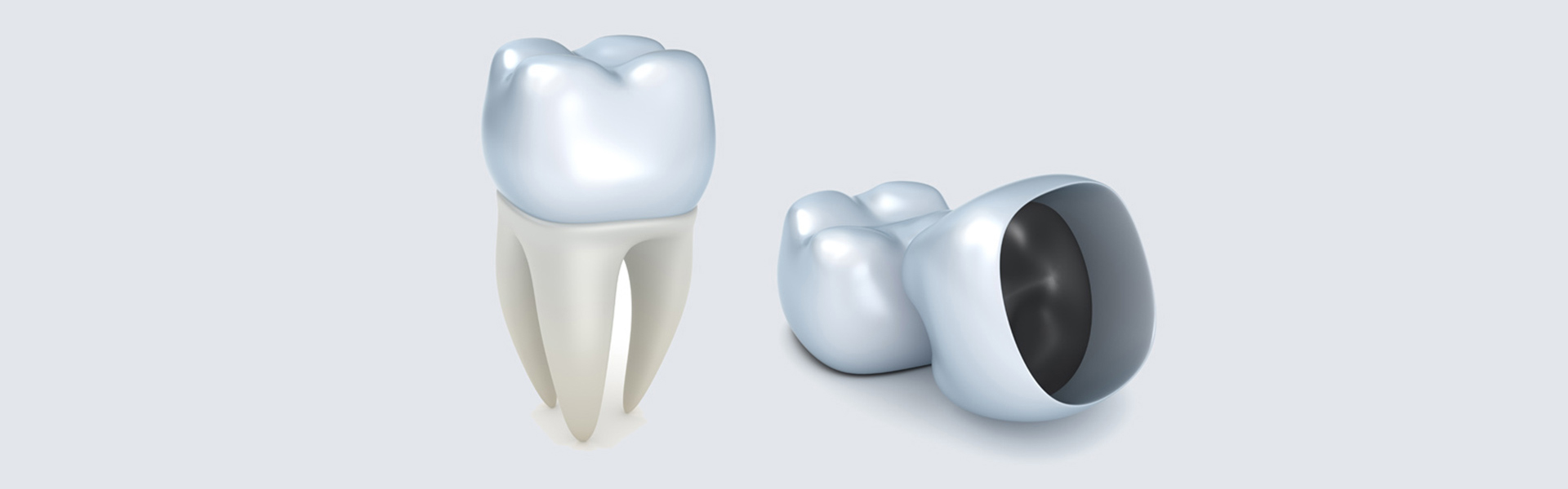 Dental Crowns