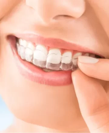 Invisalign