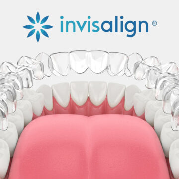 How Invisalign Works: A Clear Guide to Straighter Teeth